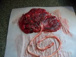 afterbirth