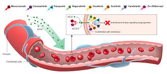 angiogenesis