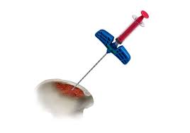 aspirate