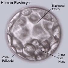 blastocyst