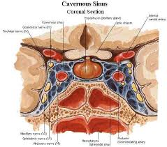 cavernous