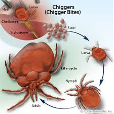 chigger