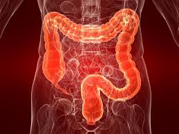 colorectal
