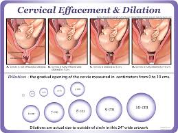 effacement