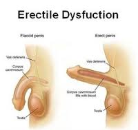 erectile