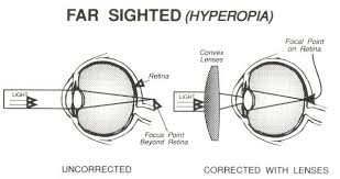 far-sighted