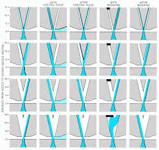 fluidics