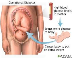 gestational