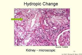 hydropic