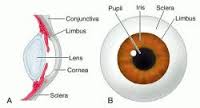 limbus