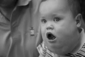 malformation