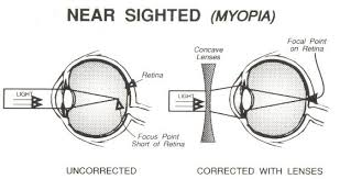 near-sighted