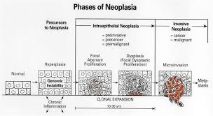 neoplastic