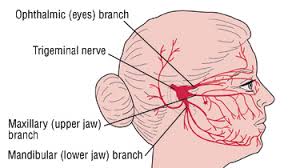neuralgia