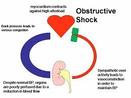 obstructive