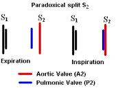 paradoxically