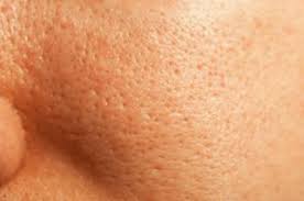 pore