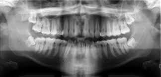 radiograph