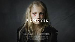 removed