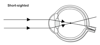 short-sighted