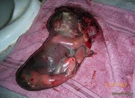 stillborn
