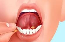 sublingual