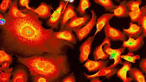 submicroscopic
